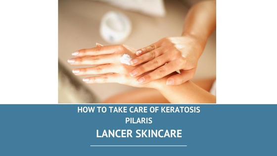 How to take care of keratosis pilaris
