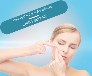 how-to-get-rid-of-acne-scars-lancer-skincare
