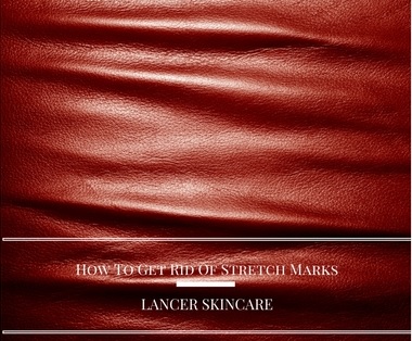 how-to-get-rid-of-stretch-marks-lancer-skincare