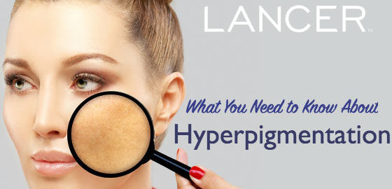 Lancer Skincare - Hyperpigmentation Causes and Treatment