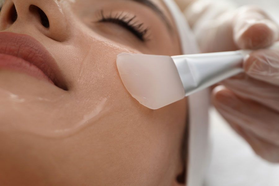 chemical peel applied to face