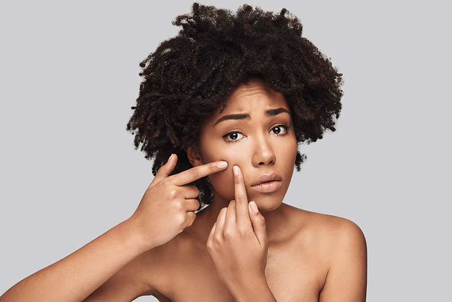 Another acne. Young sad African woman squeezing pimple while standing against grey background