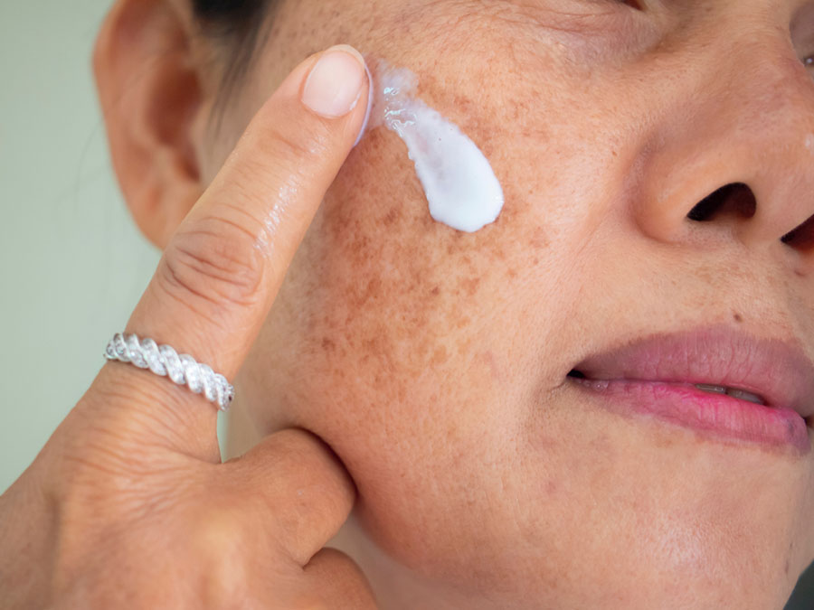 Asian woman are applying cream for facial treatment problem spot melasma pigmentation skincare on her face.