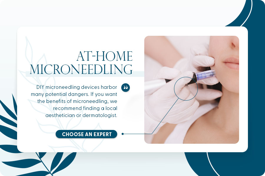 at-home microneedling